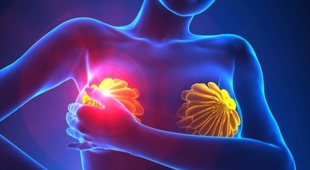 Tumore al seno, algoritmo individuerà la cura su misura. «Rivelato il rischio metastasi»