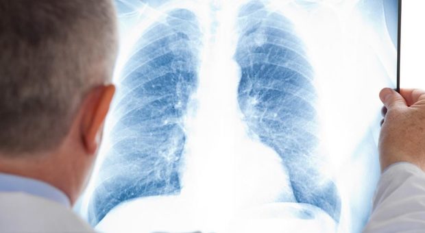 Oltre 150 casi di polmonite in 6 comuni del Bresciano. «Possibile batterio nell'acqua»