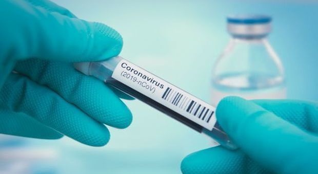 Coronavirus, Napoli: estubati due pazienti trattati col farmaco anti-artrite