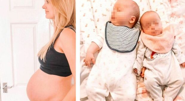 39enne partorisce due gemelli concepiti a tre settimane di distanza