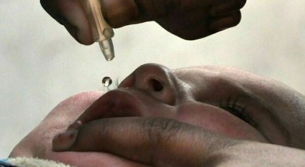 Poliomielite, l'Italia aumenta i controlli per capire se il virus stia già circolando