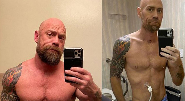 Infermiere sedato e intubato per 6 settimane per sconfiggere il Covid19: «Ho perso 23 chili». Mike Schultz (Instagram)