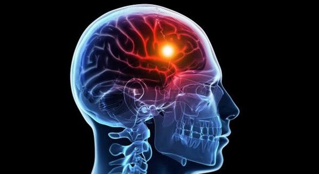 Ictus, scoperto dispositivo che media la memoria: potrebbe prevenire le amnesie e riattivare i ricordi