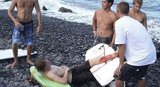 Surfista di 19 anni sopravvive all'attacco di uno squalo bianco: «L'ho preso a calci»