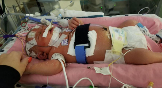 Meningite, neonata muore: Mariana, 18 giorni, ha contratto il virus dell'herpes da un amico di famiglia