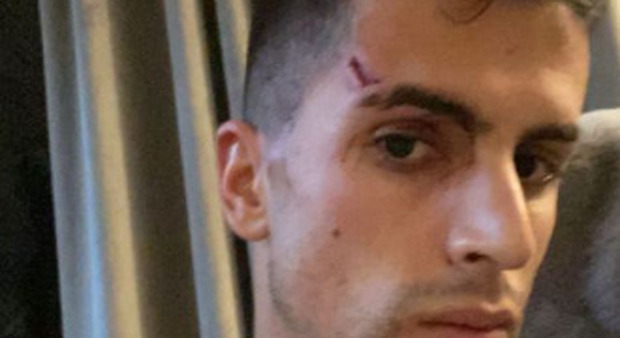 Joao Cancelo, notte di terrore: rapinato e ferito nella sua villa a Manchester