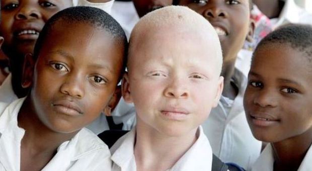 Bimbi a scuola in una foto di repertorio, spesso i piccoli albini sono vittime di efferati delitti