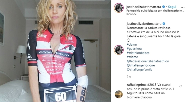 Justine Mattera ferita in un incidente in bici: «Ho finito la gara sanguinante»