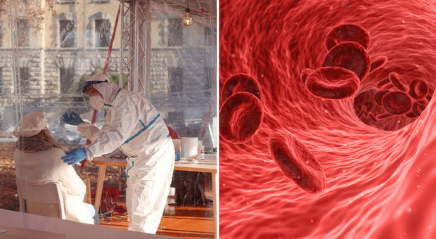Il Covid aumenta il rischio di coaguli nel sangue "fatali" fino a sei mesi dopo l'infezione