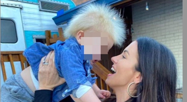 Locklan, il bimbo con la sindrome dei capelli impettinabili: la scoperta su Instagram