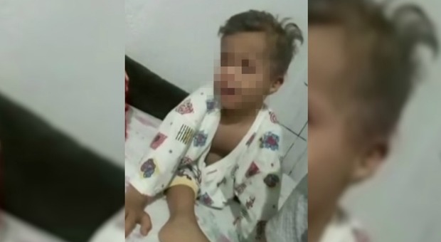 Bimbo di cinque anni con sindrome di Down muore in ospedale dopo undici ore di attesa sulla sedia del pronto soccorso