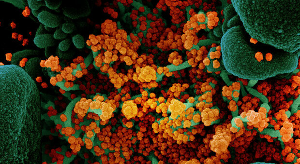 Febbre di Lassa, cos'è il virus simile all'Ebola: sintomi, incubazione, terapia e prevenzione