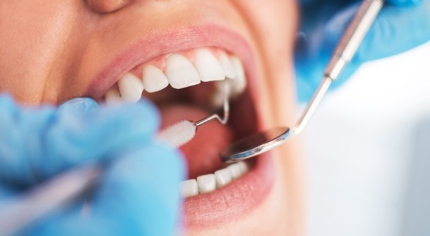 Il dentista le estrae dieci denti per un'infezione alle gengive: donna muore dissanguata