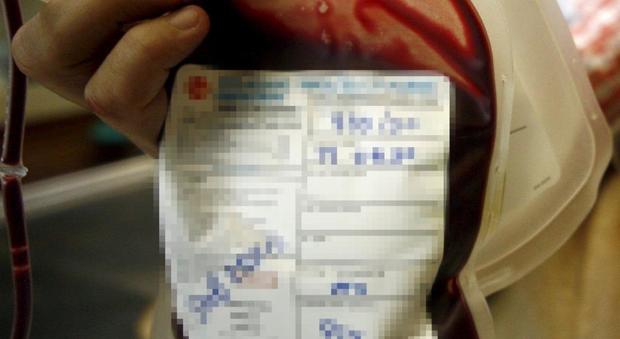 Sangue infetto, confermata in appello la condanna per una trasfusione del 1975