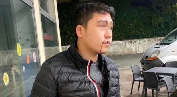 Coronavirus, giovane cinese aggredito: gli hanno spaccato una bottiglia in faccia. «Nessuno l'ha difeso»