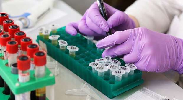 Coronavirus, test rapidi al laboratorio dell'ospedale di Pescara