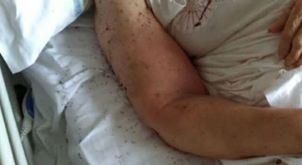 Salerno, cadavere di una donna ricoperta di insetti all'ospedale: lo choc della famiglia