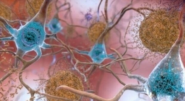 Alzheimer, scoperto nuovo farmaco che modula l'enzima che lo causa: lo studio Usa