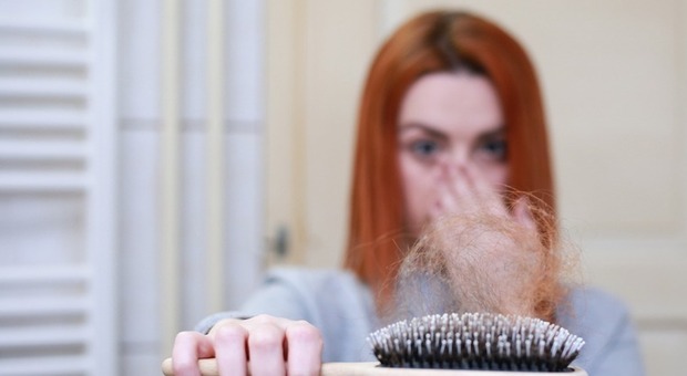 Perdita di capelli, in aumento i casi tra le giovani e giovanissime: ecco i consigli degli esperti
