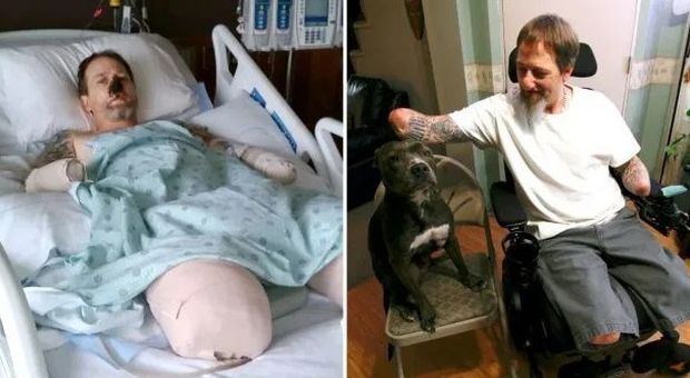 Il cane di casa lo lecca, il padrone 49enne contrae un'infezione: braccia e gambe amputate