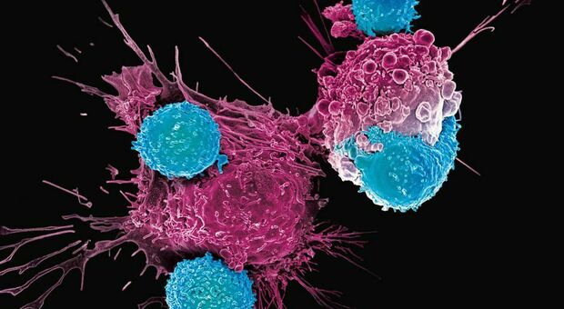 Cancro, nuove terapie geniche contro la leucemia sperimentate anche contro i tumori solidi