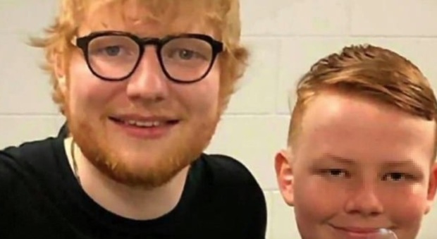 Australia, picchiato dai bulli per i capelli rossi tenta il suicidio due volte in un mese: Ed Sheeran sostiene la sua battaglia