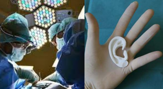 Nata con una malformazione i medici le trapiantano l'orecchio stampato in 3D fatto di cellule umane: è il 1° impianto fatto con tessuti viventi