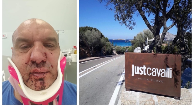 Porto Cervo, «Devo entrare in discoteca» e picchia un soccorritore del 118