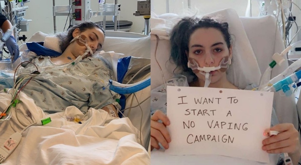Sigaretta elettronica, ragazza su Instagram mostra il suo calvario: «Svapavo, ho rischiato la vita»