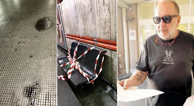 Roma, acido dal soffitto della stazione: passeggero ustionato in metro A