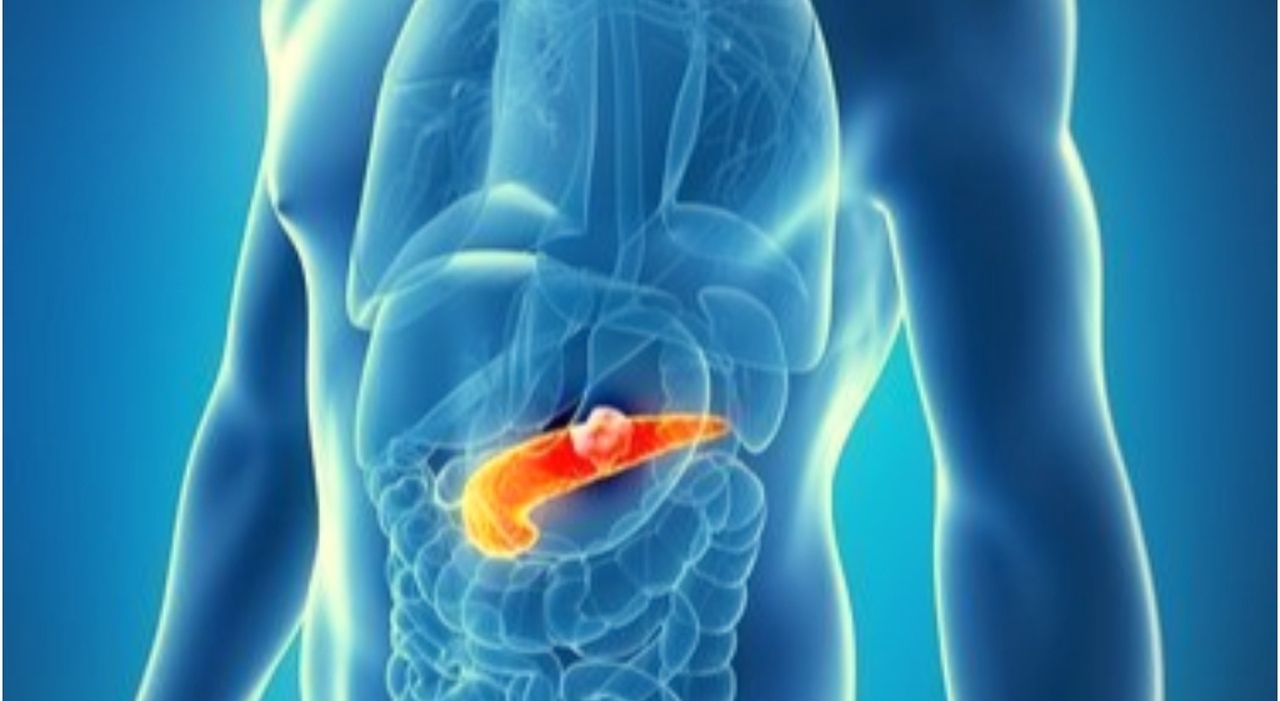 Photo of Pancreatic cancer, a new American treatment that eliminates cancer in more than 20% of cases