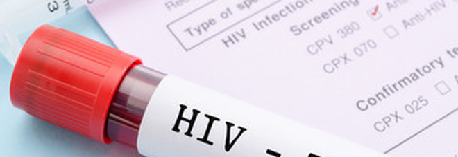Aids, crescono le donne sieropositive infettate dai mariti
